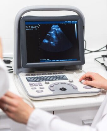 ECHO (Echocardiography)